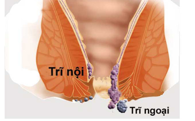 bai thuoc chua benh tri noi ngoai tai nha